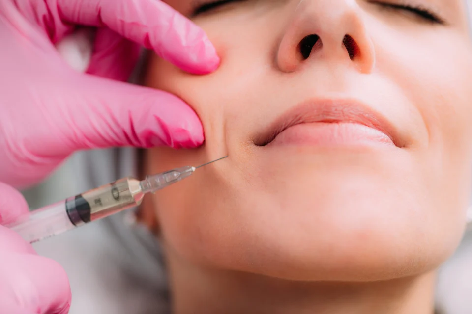 Faltenbehandlung bei Juvanity Lampertheim