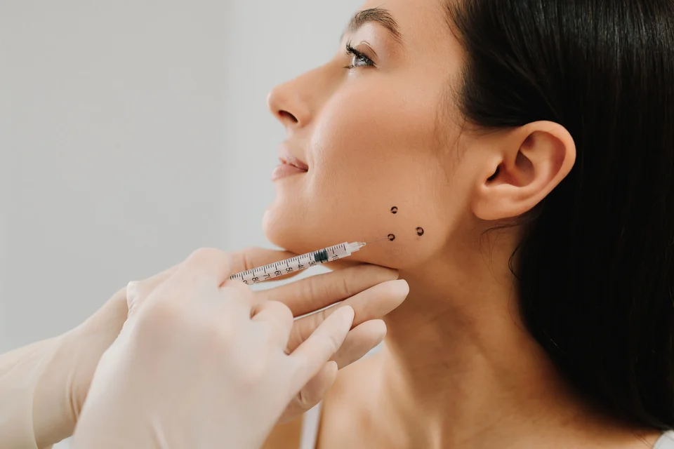Jawline-Contouring mit Hyaluronsäure